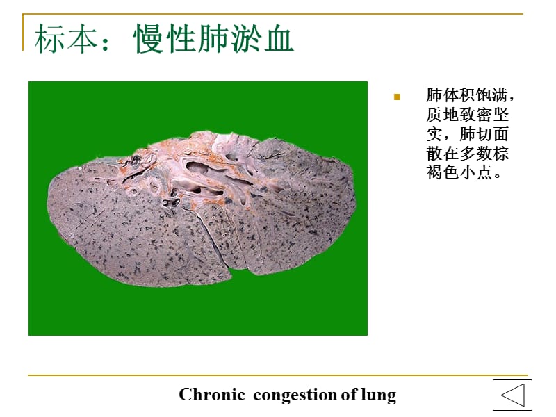 病理学实验大体标本+有病理诊断_第1页