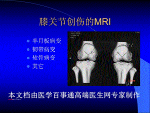 MRI在膝关节创伤的应用