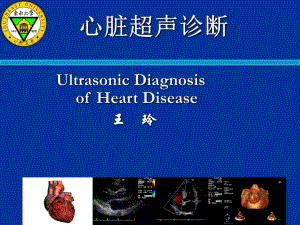 心脏超声诊断解剖及正常断面ppt课件