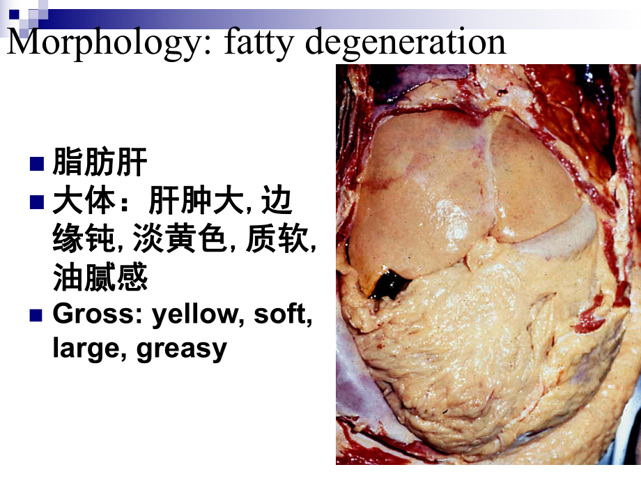 压迫性萎缩(compression atrophy)