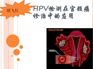 《HPV型别检测》PPT课件