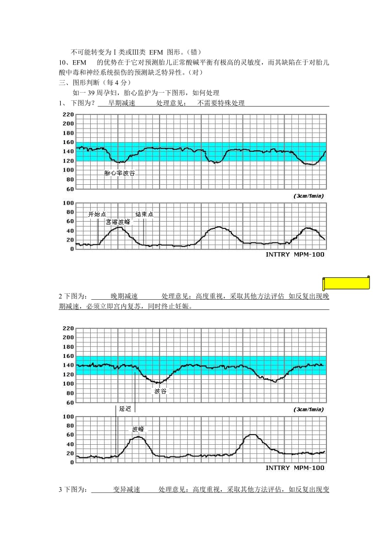 电子胎心监护试题_第2页