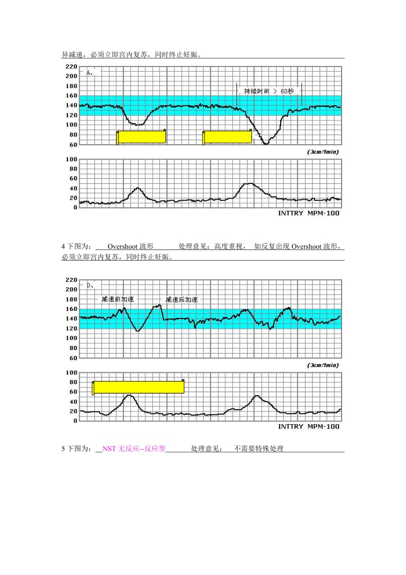 电子胎心监护试题_第3页