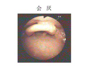 纖維支氣管鏡圖譜