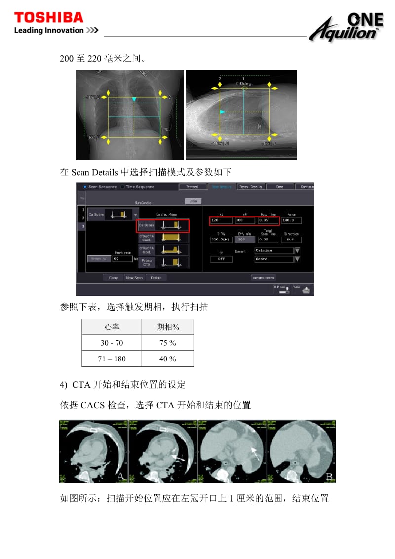 东芝320CT操作手册---8.320CT-心脏CT检查_第3页