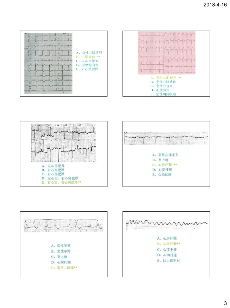 中医规培考试-心电图,X光片测试题目.pdf_第3页