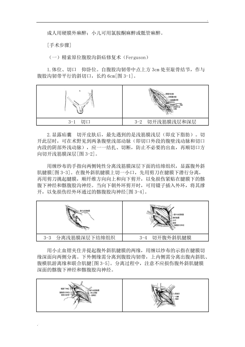 一般腹股沟斜疝修复术手术图谱_第3页