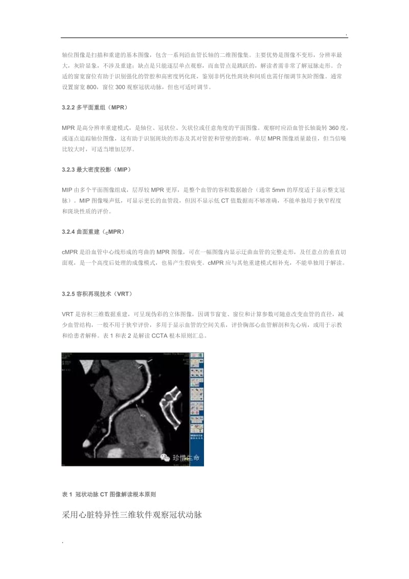 冠状动脉CT图像解读和报告指南：2014年SCCT指南_第2页