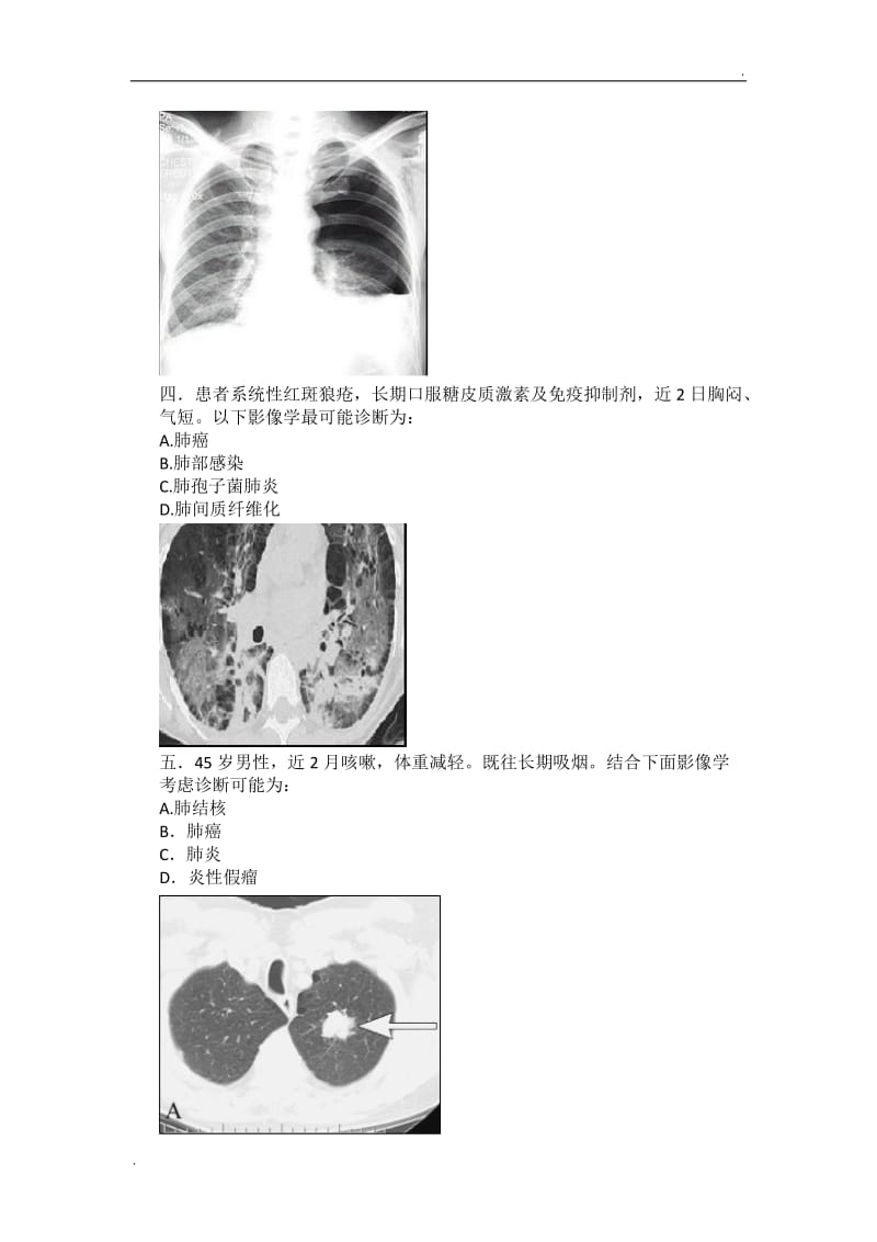 呼吸内科：辅助检查结果判断试题_第2页