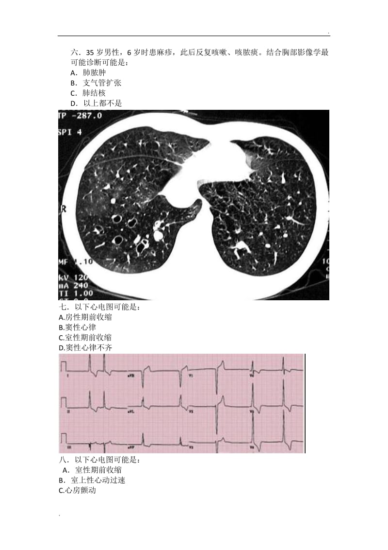 呼吸内科：辅助检查结果判断试题_第3页