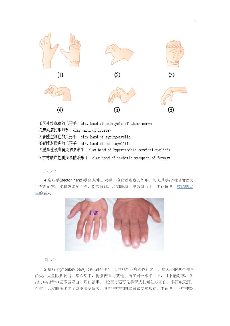 体格检查——四肢与关节检查7_第3页