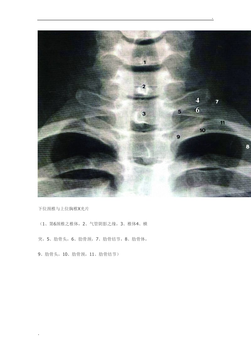 全脊柱影像学诊断_第2页