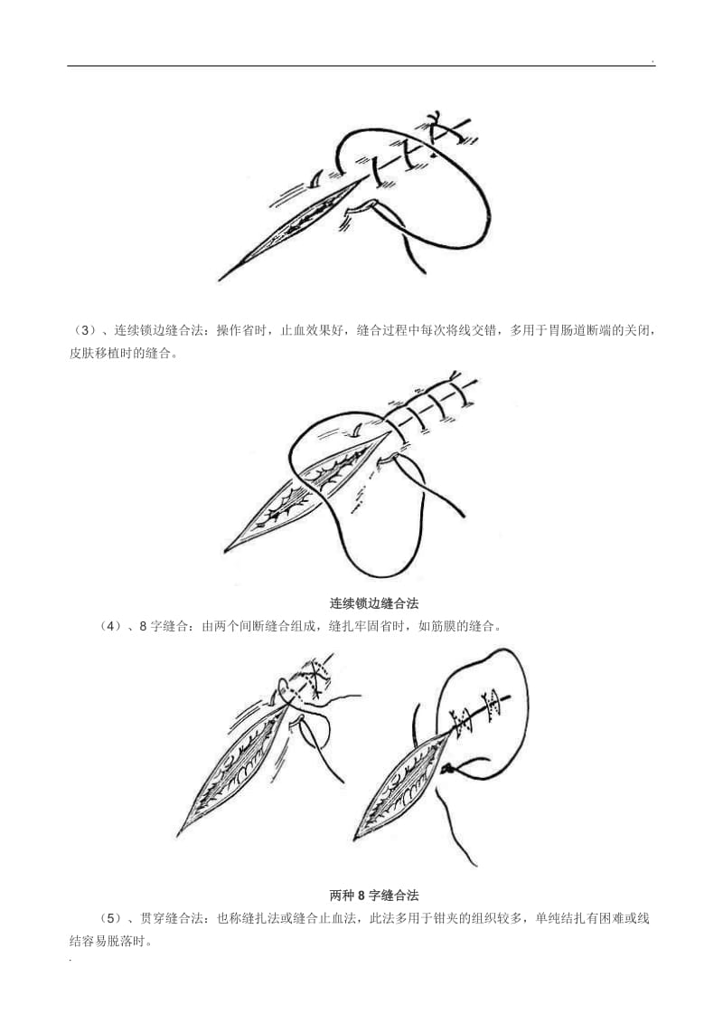 外科缝合与打结(图解)_第3页