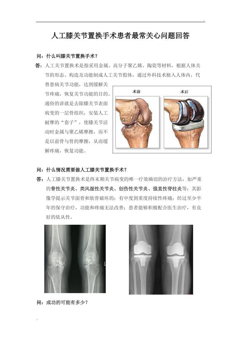 人工膝关节置换术宣教手册_第1页