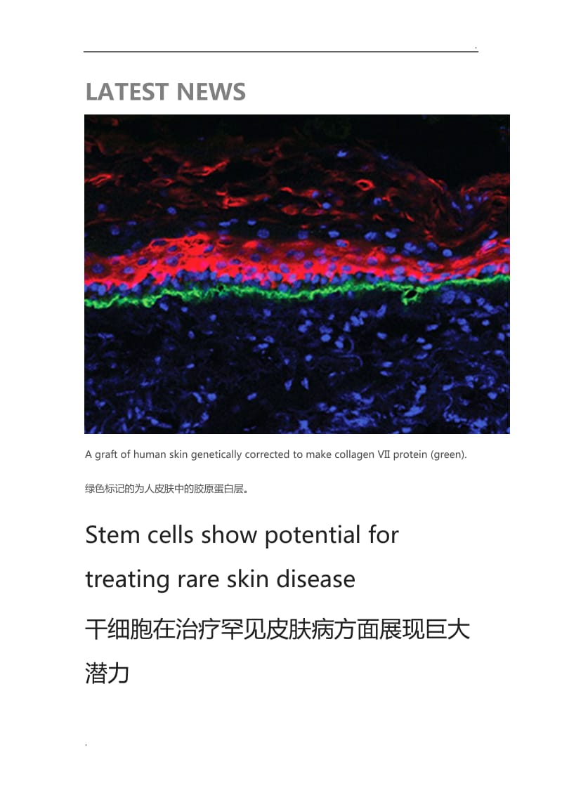 干细胞治皮肤病_第1页