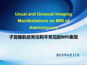 子宫腺肌症常见和不常见的MRI表现中英文对照