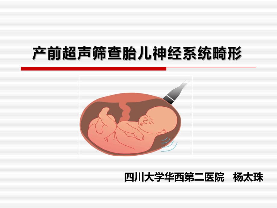 杨太珠产前超声筛查胎儿神经系统畸形.ppt_第1页