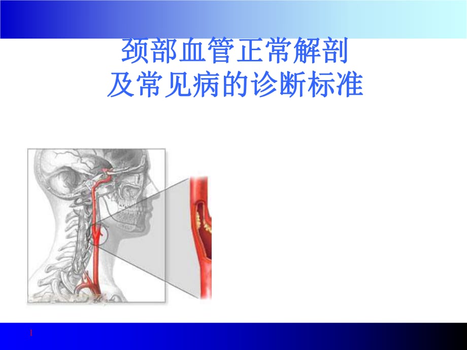 颈部血管超声正常解剖及常见病的超声诊断标准_第1页