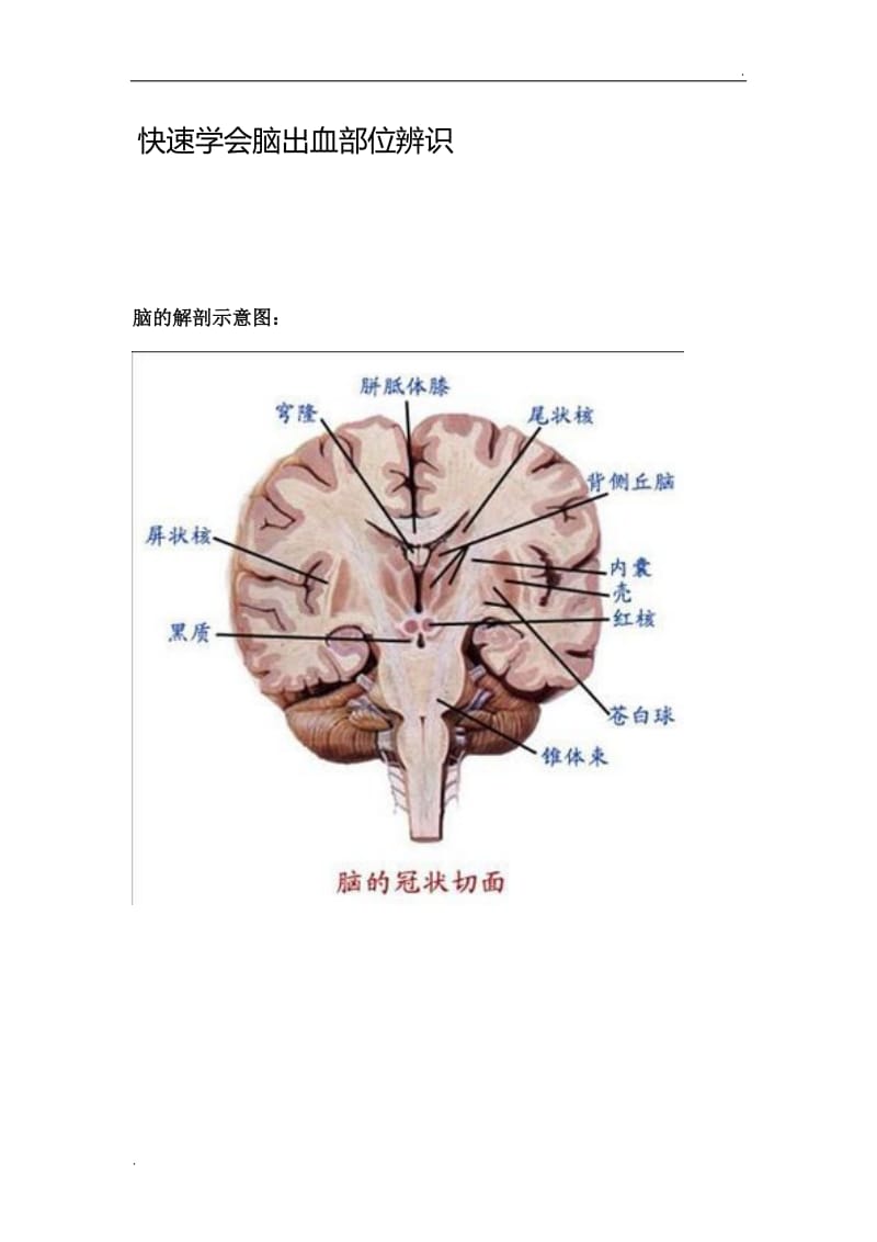 脑出血常见部位_第1页