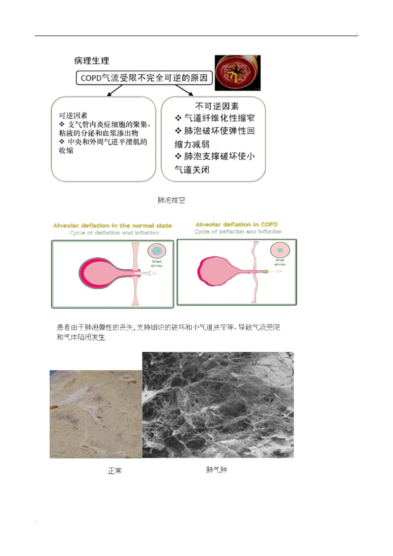 慢性阻塞性肺病和慢性肺源性心脏病_第2页