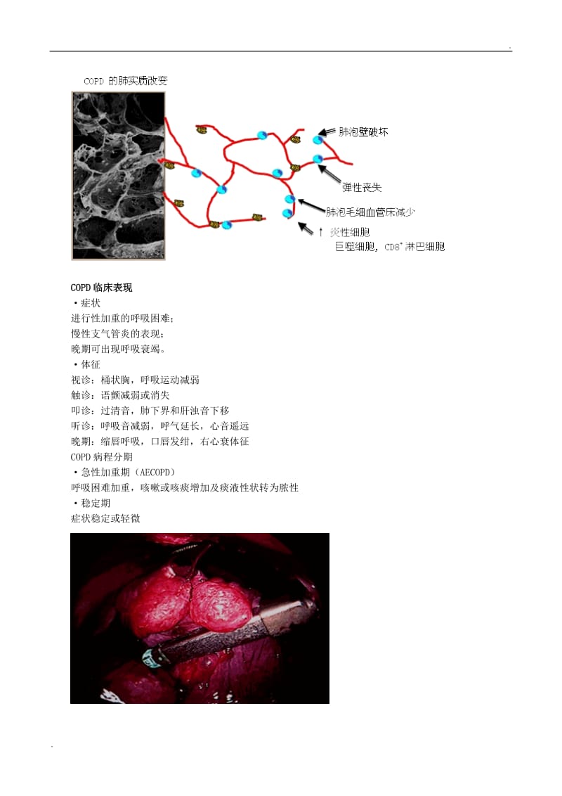 慢性阻塞性肺病和慢性肺源性心脏病_第3页