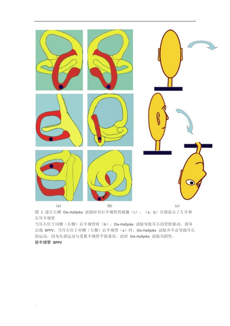 良性阵发性位置性眩晕诊断：10 张图帮你理清_第2页