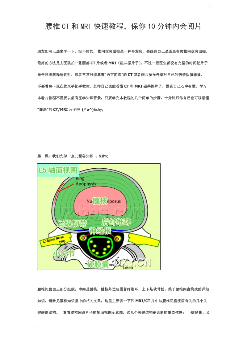 腰椎CT和MRI快速教程,保你10分钟内会阅片_第1页