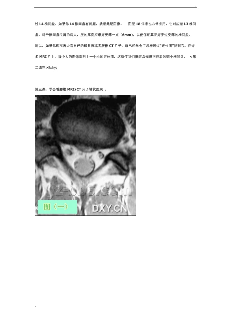 腰椎CT和MRI快速教程,保你10分钟内会阅片_第3页