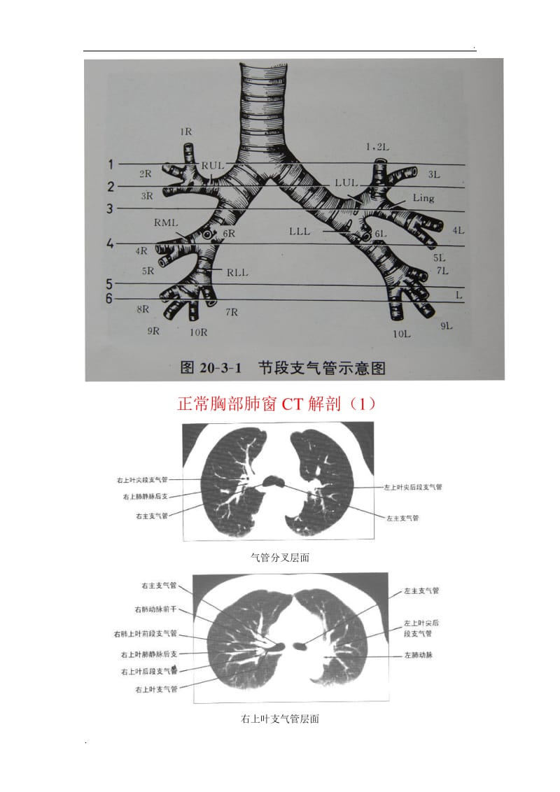 正常胸部CT(肺窗和纵隔窗)_第1页