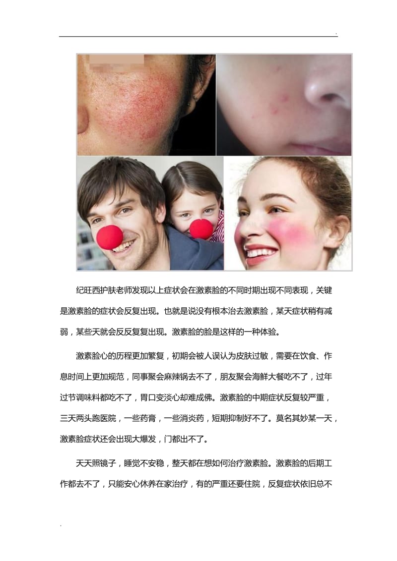 激素脸怎么治疗彻底,激素脸怎样才算彻底修复好呢才算完全康复_第2页