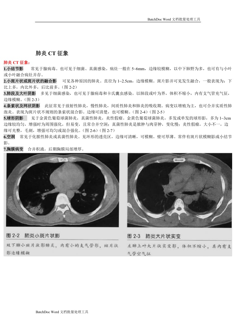 肺炎CT征象资料_第1页