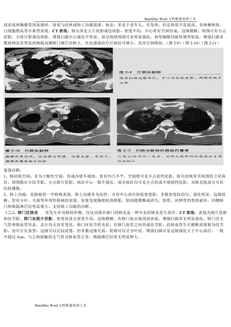 肺炎CT征象资料_第3页