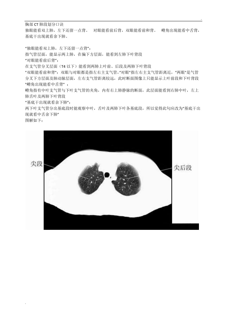 胸部CT肺段划分口诀_第1页