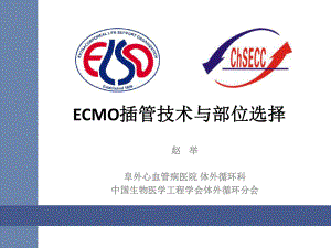 ECMO插管技术与部位选择