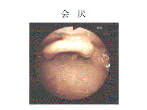 纖維支氣管鏡解剖