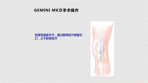 Link_Gemini板式器械手术操作