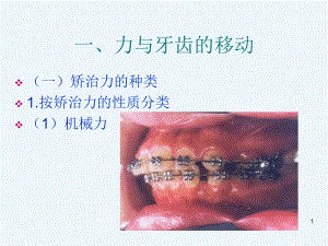 【大學(xué)課件】口腔正畸學(xué) 正畸治療的生物機(jī)械原理PPT