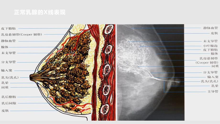 全数字化乳腺机的临床应用PPT课件_第1页