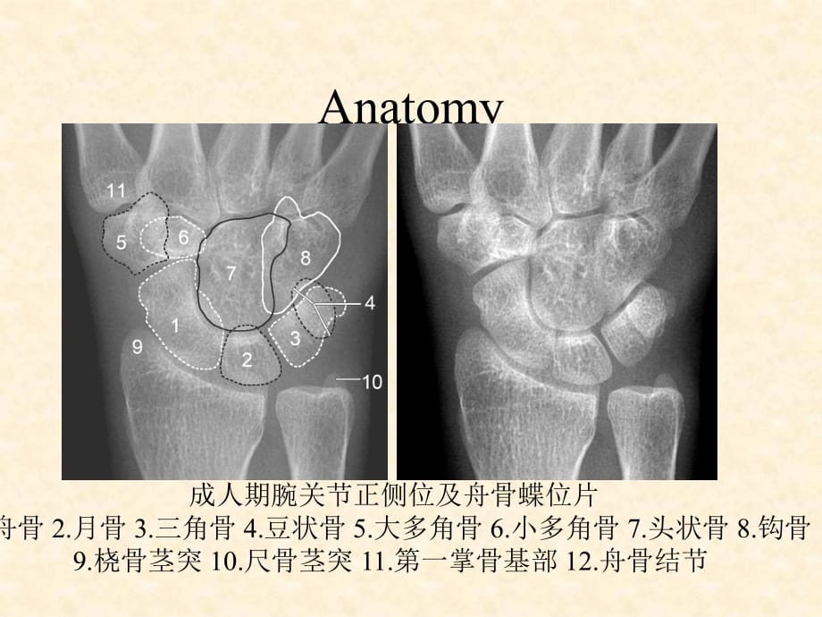 腕关节x线解剖图图片