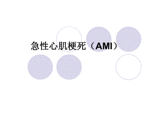 急性心肌梗死AMI