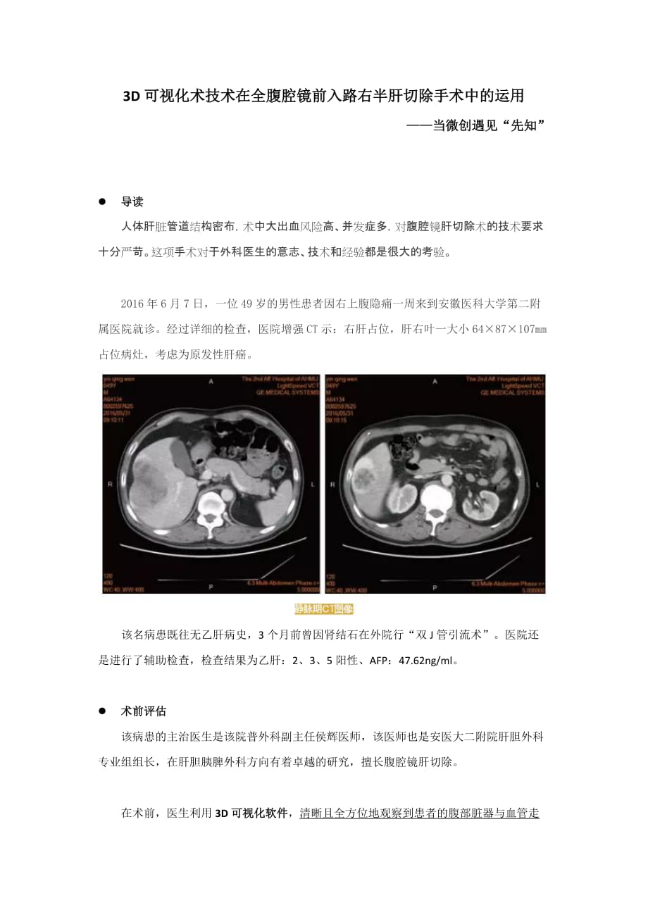 3D可视化术技术在全腹腔镜前入路右半肝切除手术中的运用_第1页