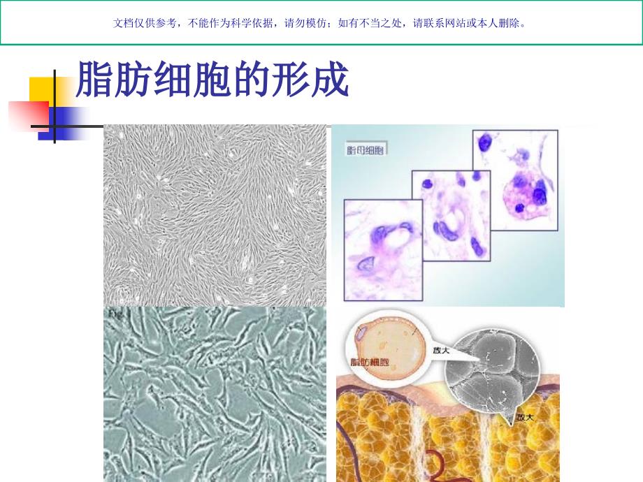 脂肪栓塞综合征课件_第1页