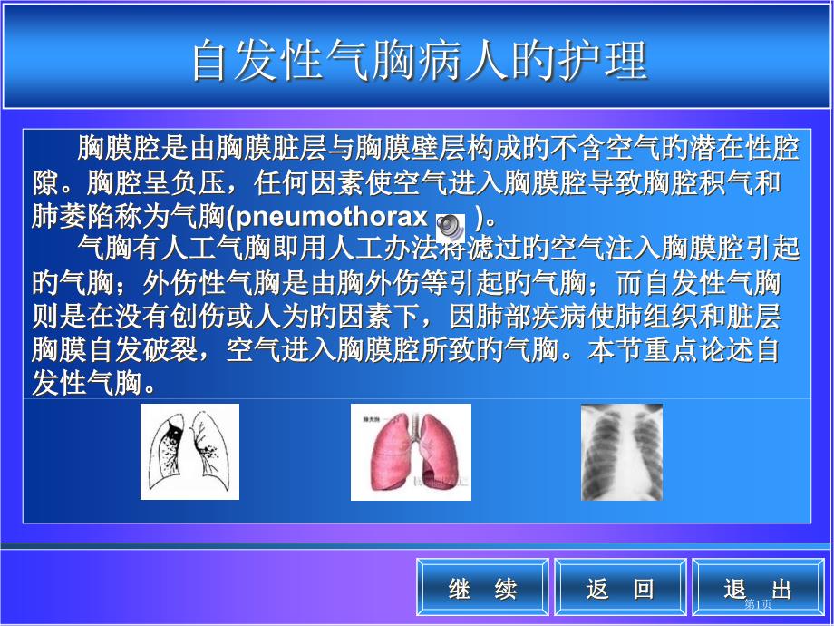 自发性气胸病人的护理主题讲座_第1页