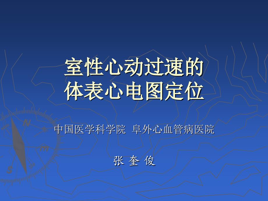 室性心动过速的体表心电图定位课件_第1页