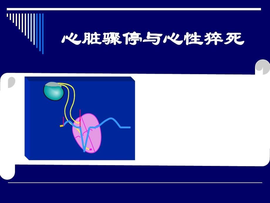 心脏骤停与心源性猝死共55张课件_第1页