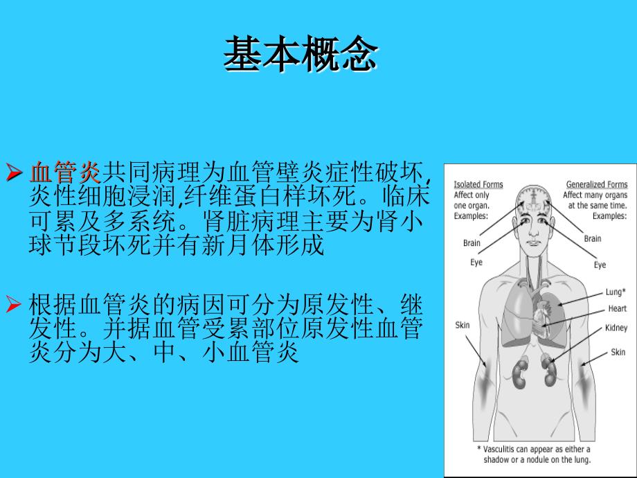 原发性血管炎课件_第1页