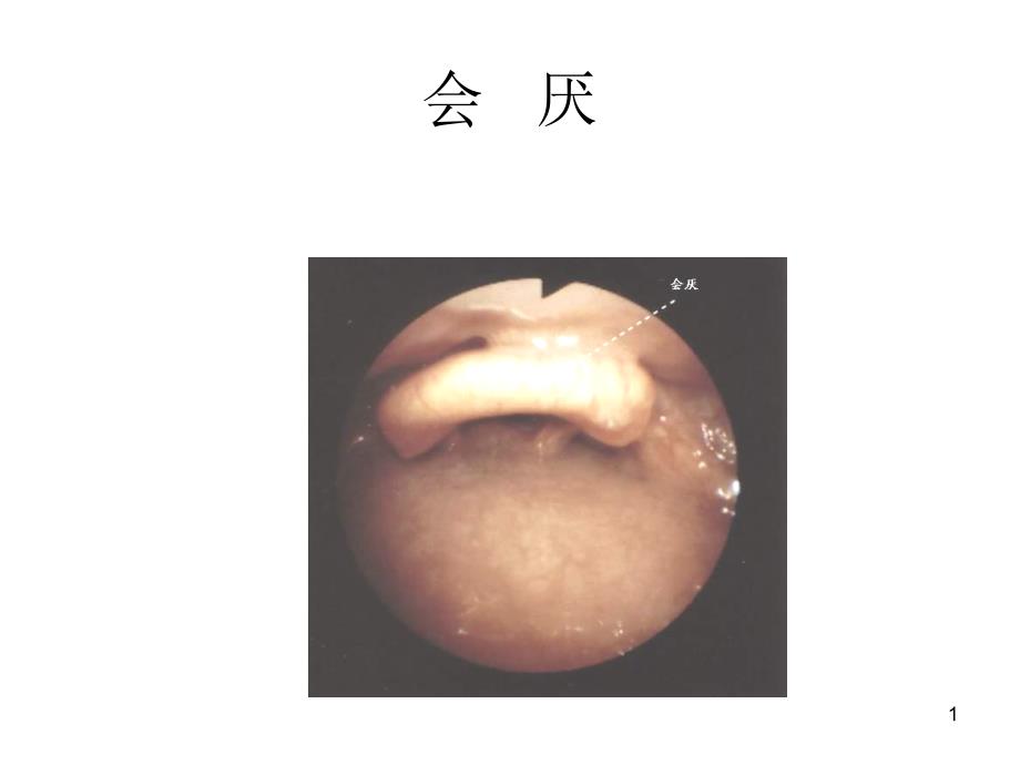 纤维支气管镜图谱医学ppt课件_第1页