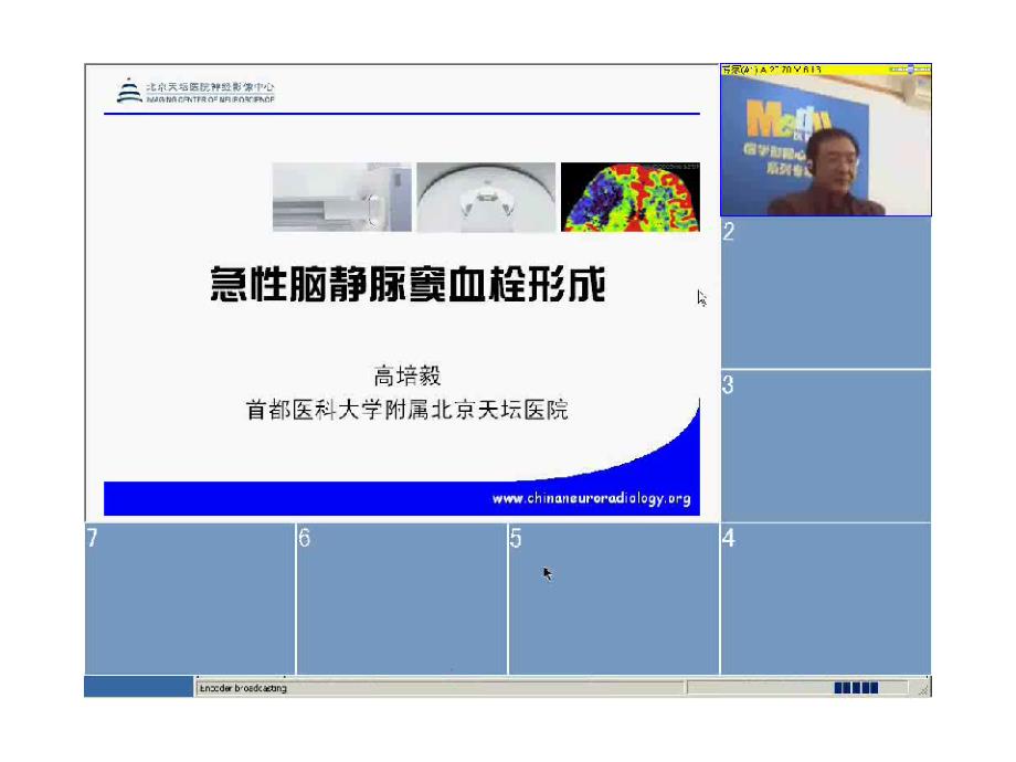 [临床医学]颅内静脉和静脉窦血栓形成的影像学表现课件_第1页