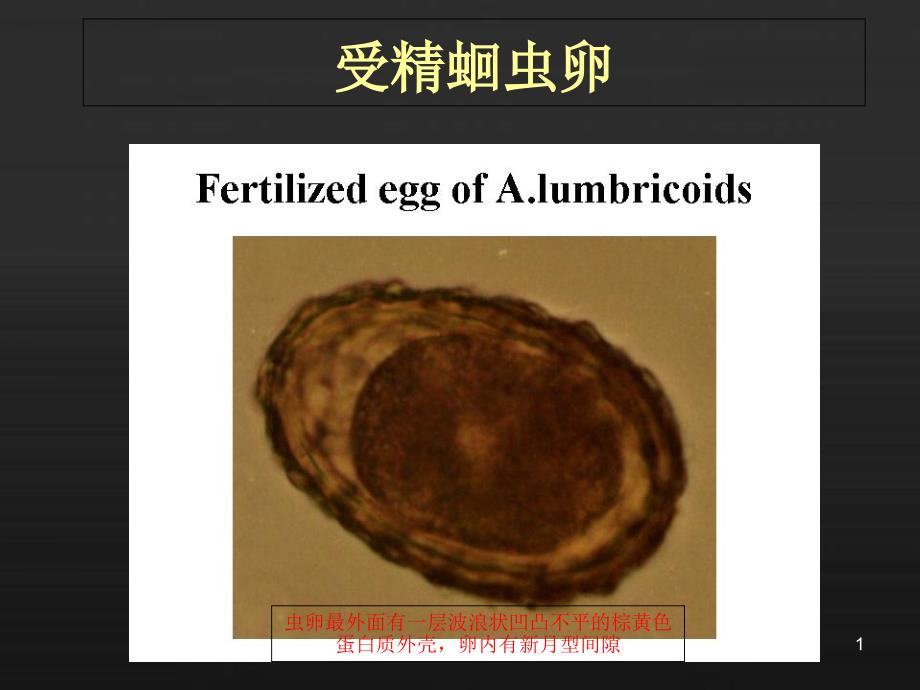 寄生虫标本考试图谱课件_第1页