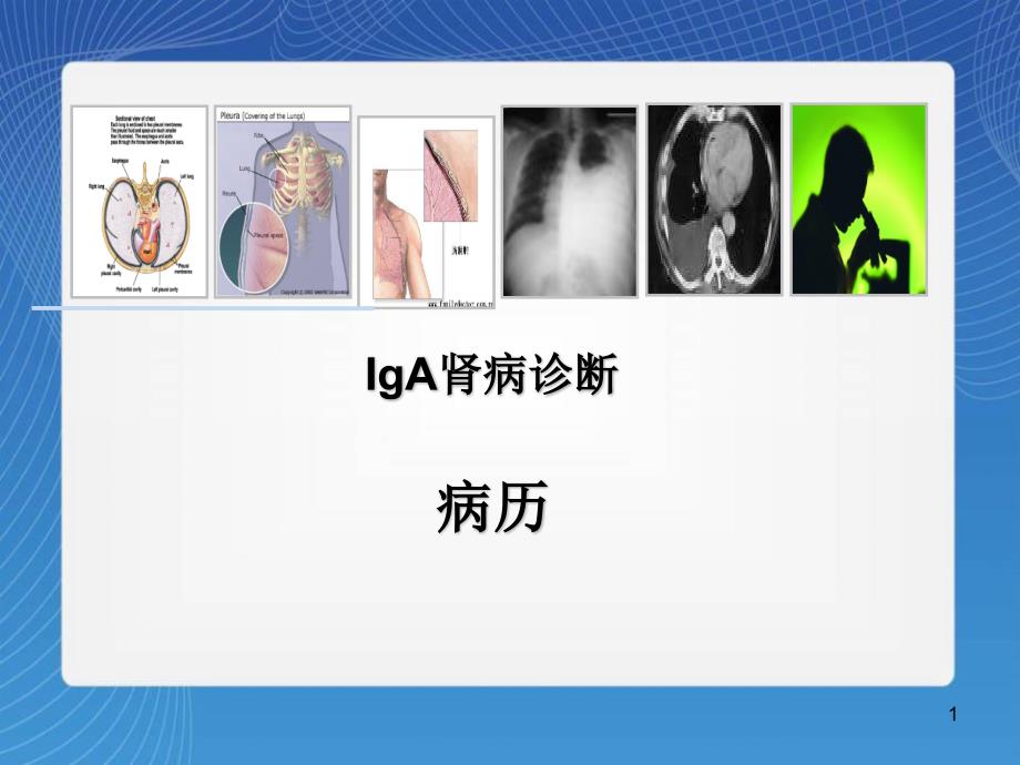 医学课件-IgA肾病诊断课件_第1页